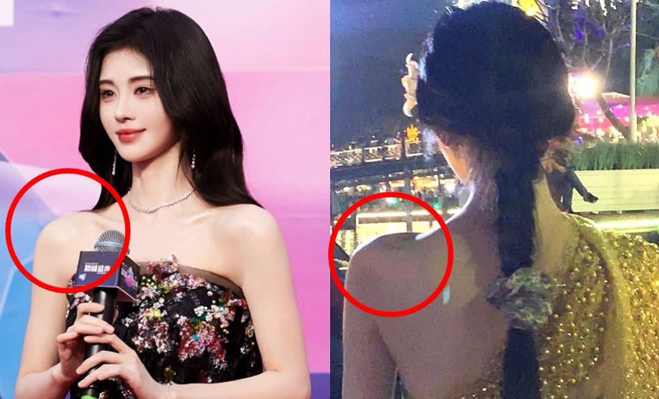 Chinese Star Kiku Ju s Odd Shoulder Shape Sparks Surgery Speculation chinese-star-kiku-ju-s-odd-shoulder-shape-sparks-surgery-speculation